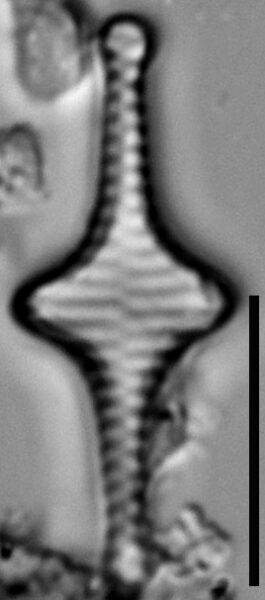 Staurosira stevensonii LM3