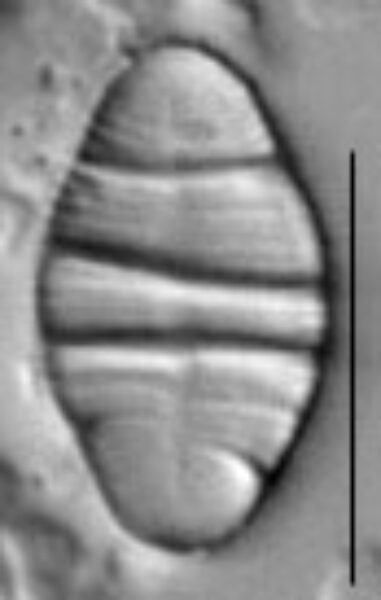 Odontidium mesodon LM1