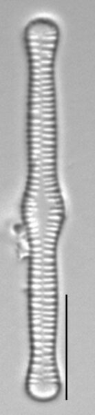 Tabellaria flocculosa LM5