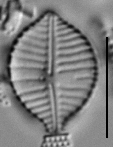 Gomphonema montezumense LM1