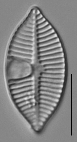 Planothidium lanceolatoide LM4