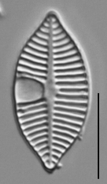 Planothidium lanceolatoide LM6