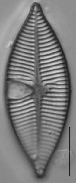 Planothidium lanceolatoide LM1