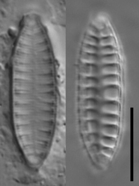 Surirella arctica LM7