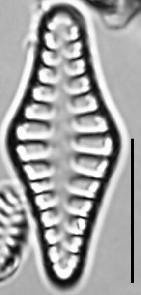 Staurosirella rhomboides LM4