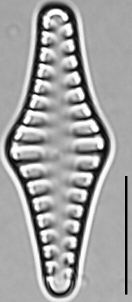 Staurosirella rhomboides LM5