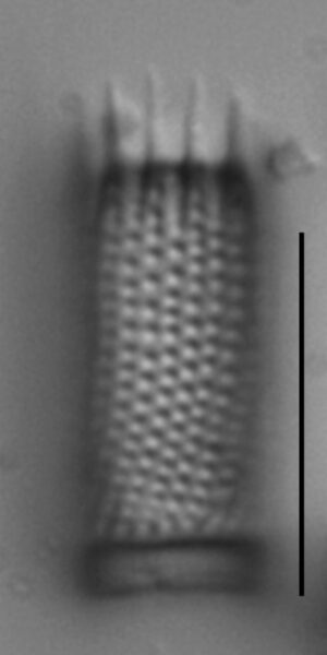 Aulacoseira subarctica LM6