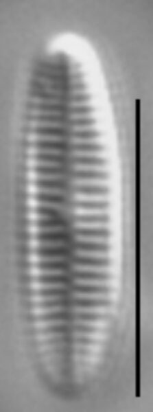 Achnanthidium atomus LM1