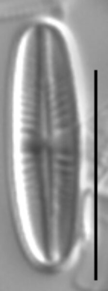 Achnanthidium atomus LM2