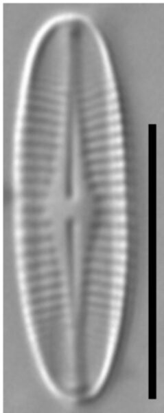 Achnanthidium crassum LM3