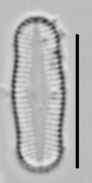 Achnanthidium Rosenstockii Vt10089 A 010418 07 C