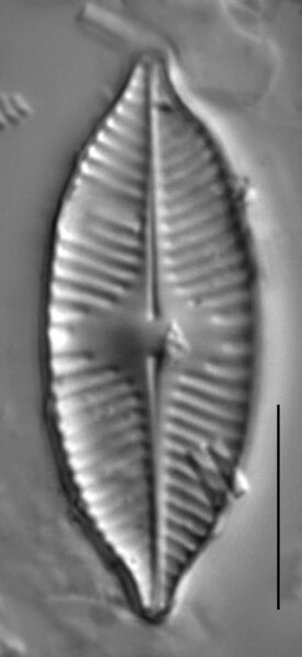 Planothidium apiculatum LM2