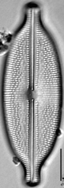 Anomoeoneis Sphaerophora LM9