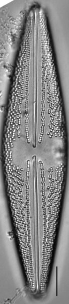 Anomoeoneis Costata LM3