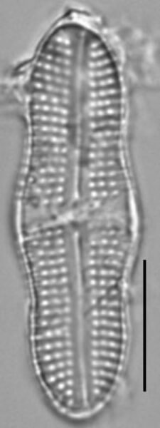 Achnanthes tumescens LM7