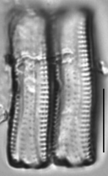 Achnanthes tumescens LM1