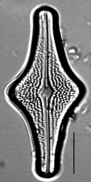 Brachysira follis LM2