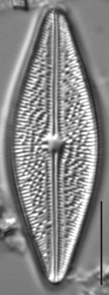 Brachysira arctoborealis LM2