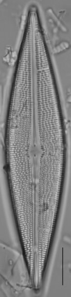 Brachysira serians LM2