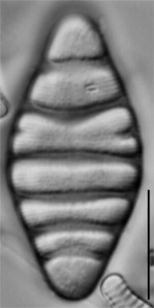 Tetracyclus hinziae LM7