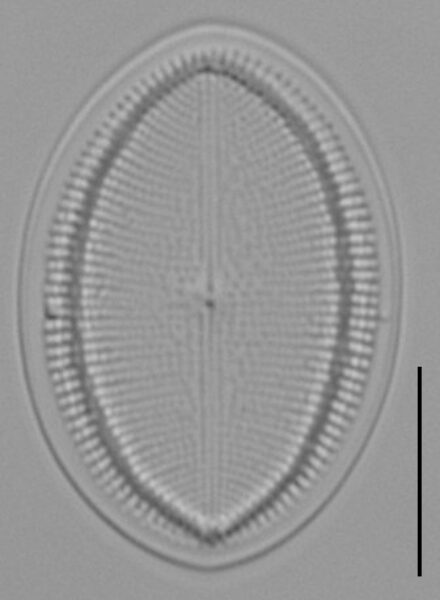 Cocconeis czarneckii LM5