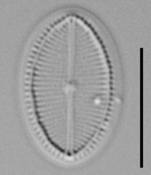 Cocconeis Neodiminuta Lm01