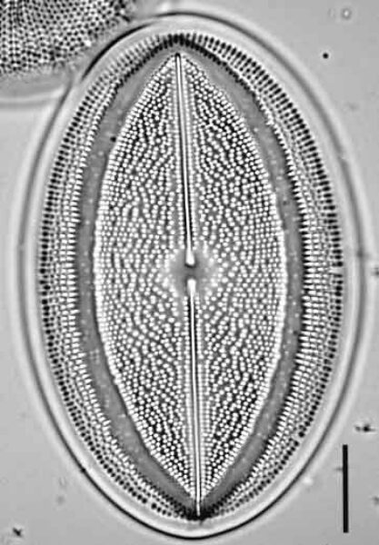 Cocconeis grovei LM1