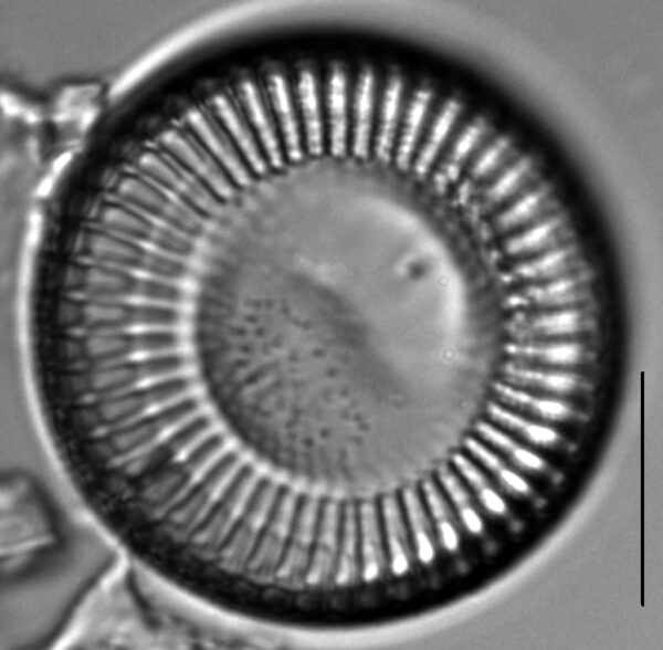 Cyclotella Gamma 5