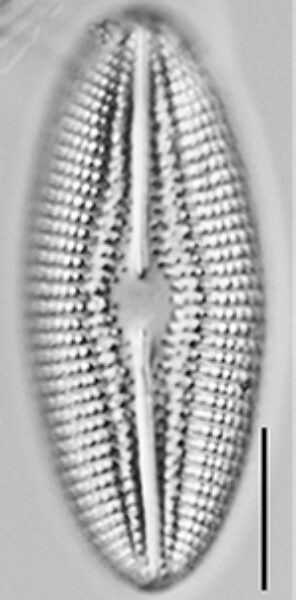 Diploneis abscondita LM1