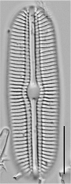 Diploneis boldtiana LM1