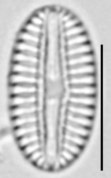 Diploneis puella LM5