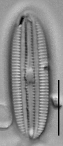 Diploneis submarginestriata LM5