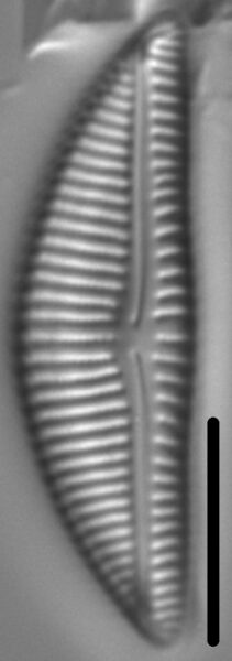 Encyonema Silesiacum LM6