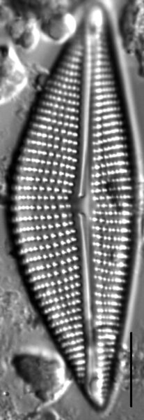 Encyonema triangulum LM3