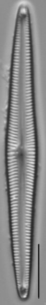 Encyonopsis Subspicula3