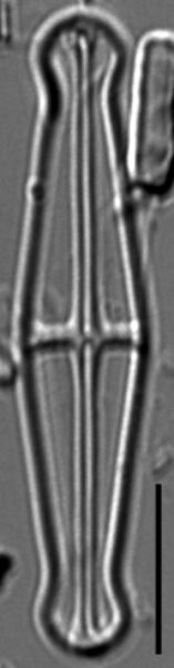 Envekadea pachycephala LM3