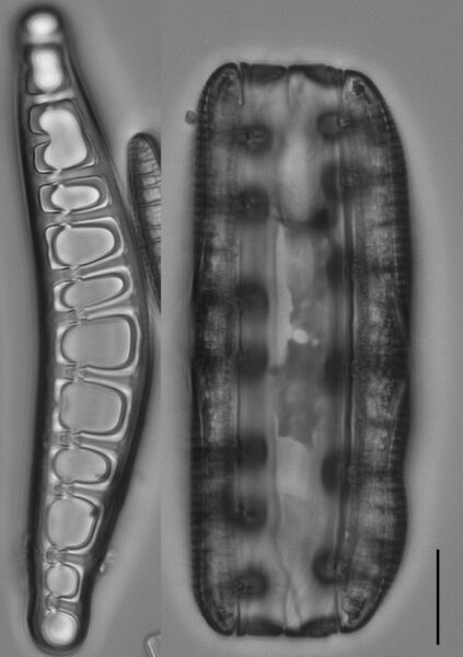 Epithemia Alpestris  Ill2017 07