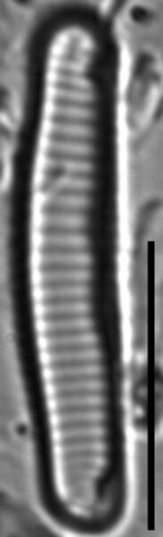 Eunotia rhomboideaLM1