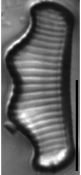 Eunotia subherkiniensis LM7