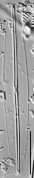 Frustulia pseudomagaliesmontana LM6