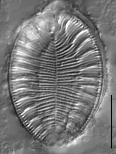 Surirella iowensis LM4