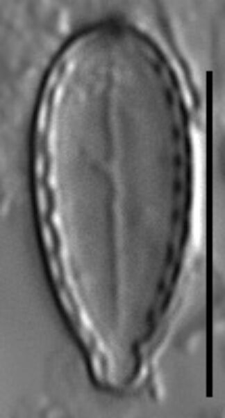 Surirella stalagma LM1