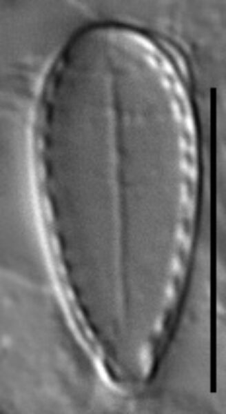 Surirella stalagma LM5