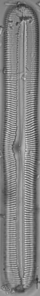 Pinnularia spinifera LM5