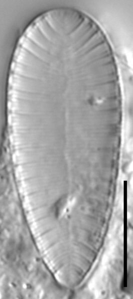 Suirella lacrimula LM2