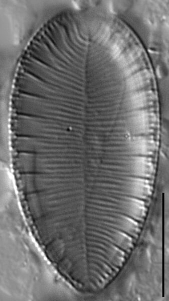 Gc112761A Brebissonii 4