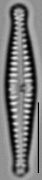 Gomphonema superiorense LM6