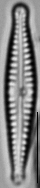 Gomphonema superiorense LM3