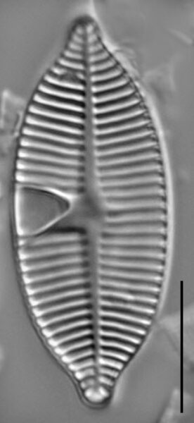 Planothidium apiculatum LM4