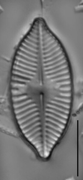 Planothidium apiculatum LM5